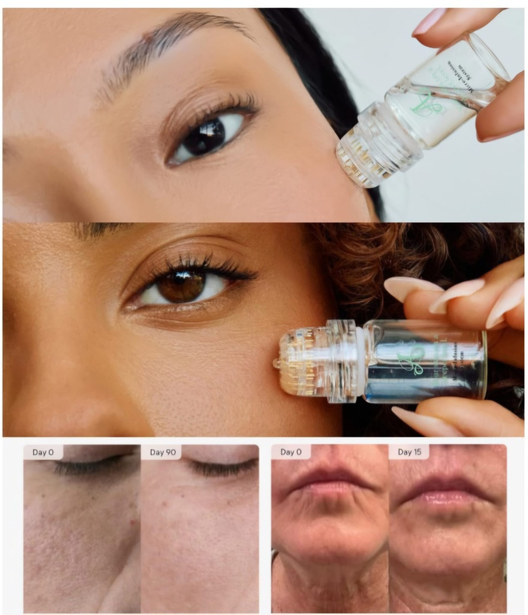 Introductieaanbieding / Micro-infusieserum